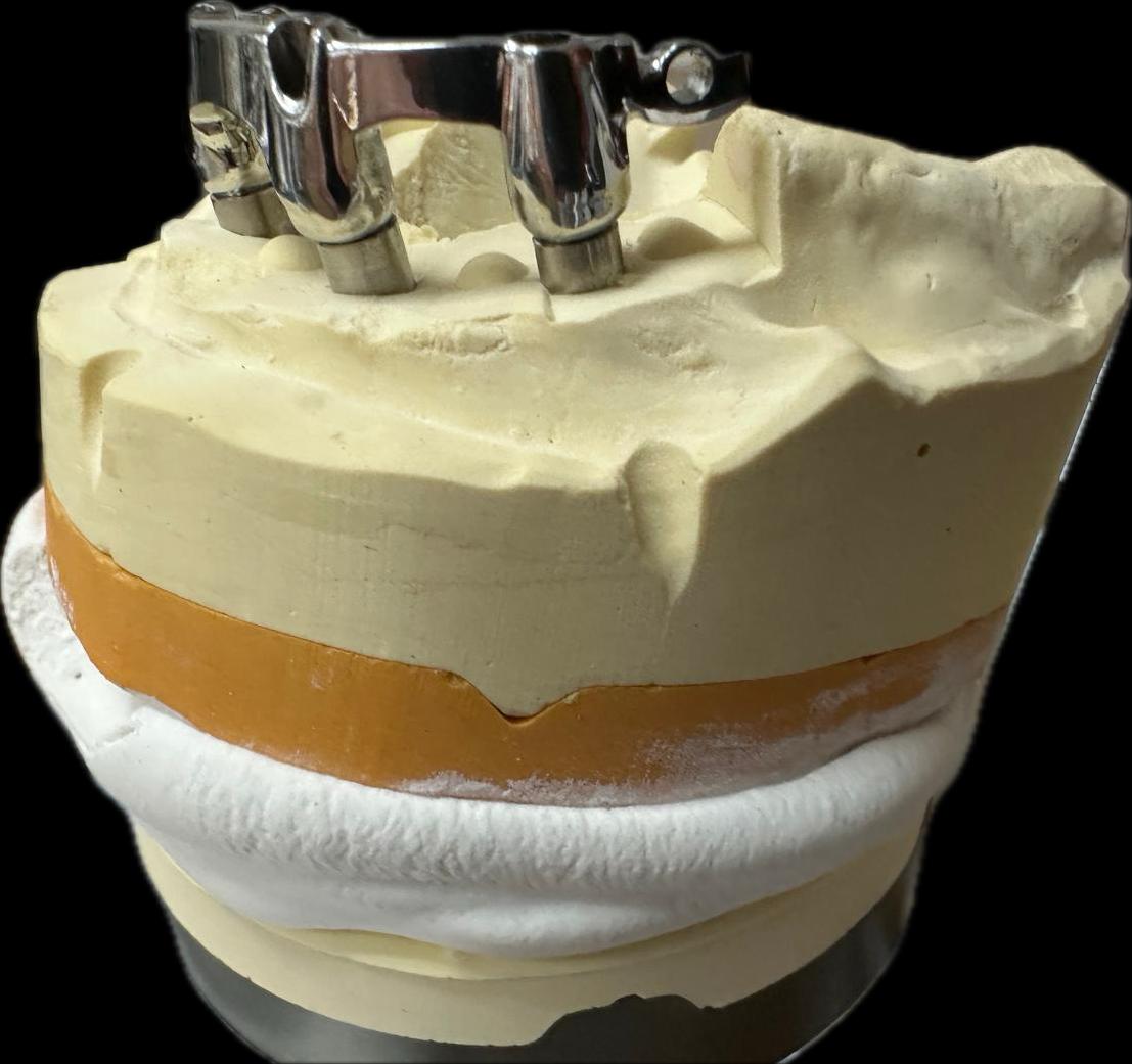 Implantatversorgung